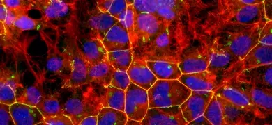 Red and blue hek 293 stained protein.