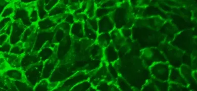 Fluorescent lime green web of  renal proximal tubular epithelial cells.