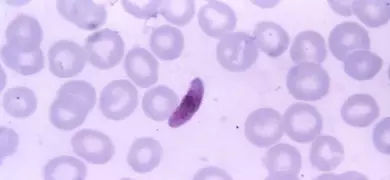 Thin film blood smear photomicrograph showing a Plasmodium falciparum microgametocyte among red blood cells, identifiable by its distinct shape and staining.