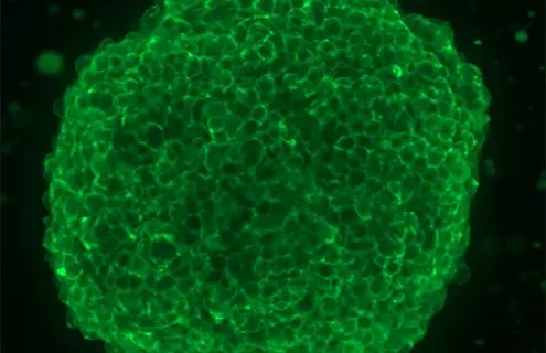 A bright-green, fluorescent, EGFR stain sphere with a black background.