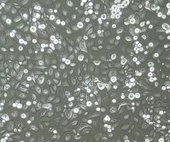 Gray and green corneal cells.