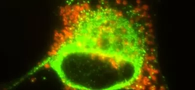 Fluorescent yellow-green and orange schwann cells.
