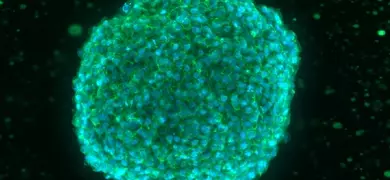 A bright blue and green, fluorescent sphere with a black background.