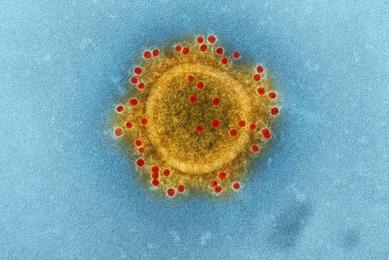 Middle East Respiratory Syndrome Coronavirus particle envelope proteins immunolabeled with Rabbit HCoV-EMC2012 primary antibody and Goat anti-Rabbit 10 n.jpg