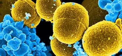 Mustard-colored, spheroid shaped, Staphylococcus aureus bacteria, that were in the process of attempting to escape their destruction by blue-colored, human white blood cells.
