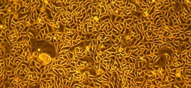 Small, yellow, orange and black primary keratinocyte cells.
