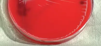 Petri dish of red blood agar with black shadowy figures.