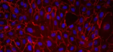 Purple, red and black human umbilical vein endothelial cells.