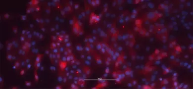Fluorescent microscopy image of renal proximal tubular epithelial cells, showing nuclei in purple and surrounding cellular structures in red against a dark background
