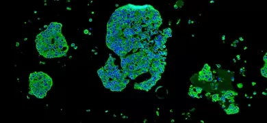 Mcf7 breast cancer cell line.