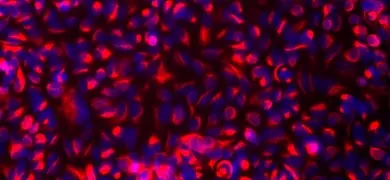 A microscopic image showing a dense cluster of cells stained with fluorescent dyes. The cells exhibit a mix of red and blue colors.