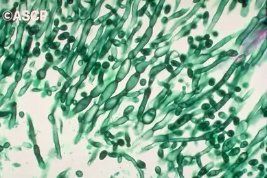 PHIL_1215 - Candida_Copyrighted image (CDC).tif