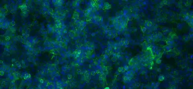 A microscopic image showing a dense network of green and blue stained colon cells with a 100 micrometer scale bar. The cells are interconnected, forming a complex structure.