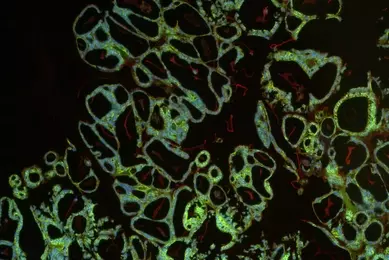 Green and red organoid cells.