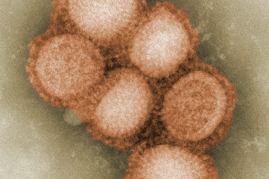 Digitally colorized transmission electron micrograph showing several spherical virions from a 2009 pandemic influenza A (H1N1) virus isolate. The viral particles are clustered together and surrounded by distinct surface spikes, highlighting characteristic structural features of the influenza virus as observed using electron microscopy.