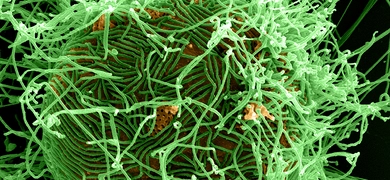 Digitally-colorized scanning electron microscopic (SEM) image depicts numerous filamentous Ebola virus particles (green) budding from a chronically-infected VERO E6 cell (orange).