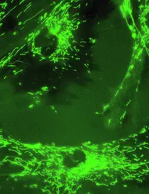 Green fluorescent mitochondria in 895 Sk cells.
