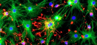 Fluorescent microscopy image of neurons stained with different dyes. Cell bodies are marked in blue, axons and dendrites in green, and other cellular components in red.