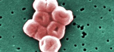 Digitally colorized scanning electron microscopic (SEM) of a highly magnified cluster of Gram-negative, non-motile, Acinetobacter baumannii bacteria (pink), as seen under a magnification of 27600X (green background).