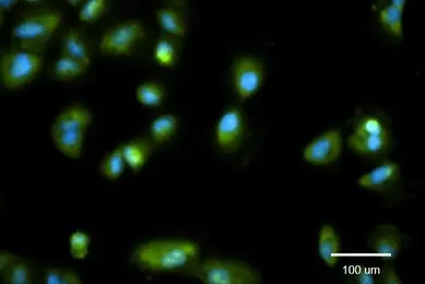  Faded, fluorescent blue and green exosome cells.