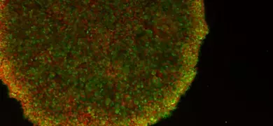 Green and red embryonic-like induced pluripotent stem cells.