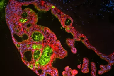 Fluorescent microscopy image of organoid cells stained in green, pink, and blue, highlighting distinct cellular components and structural features.
