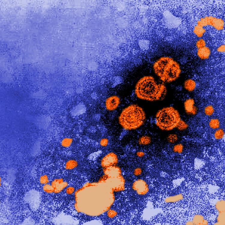 Transmission electron microscopic (TEM) image revealed the presence of hepatitis B virus (HBV) particles (orange). The round virions, which measure 42nm in diameter, are known as Dane particles.