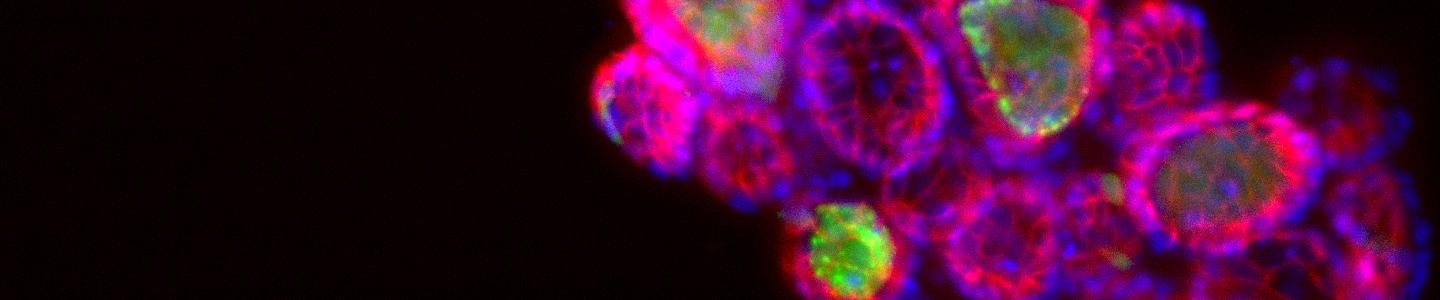 Purple and pink sanger11 ecad 647 organoid cells.