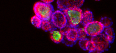 Purple and pink sanger11 ecad 647 organoid cells.