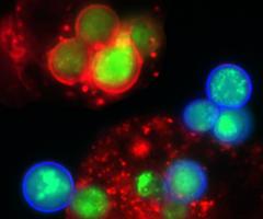 Green and red yeast with macrophage cells
