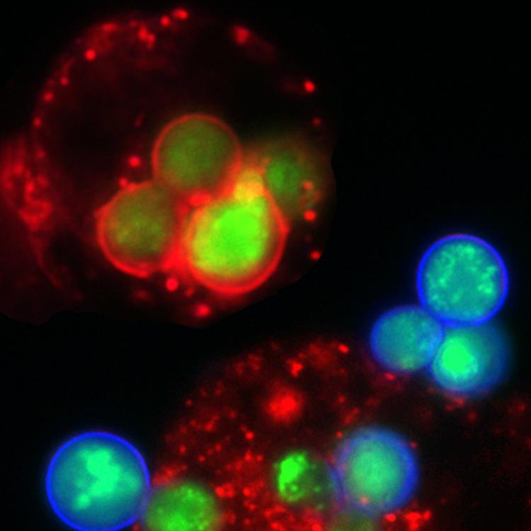 Green and red yeast with macrophage cells